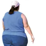 Obezitenin faturası da ağır geldi